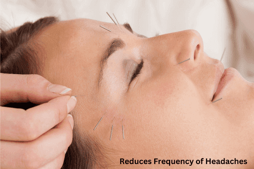 Reduces Frequency of Headaches